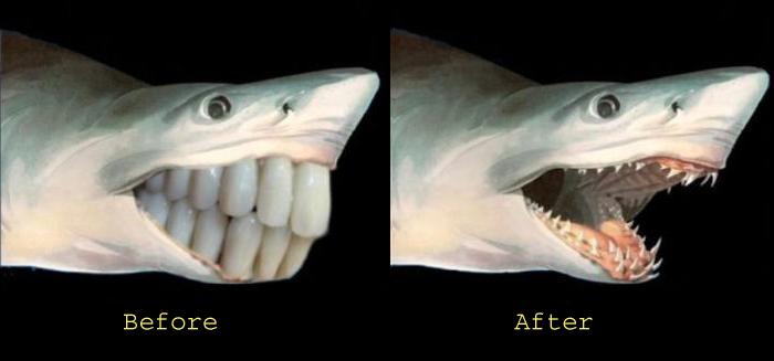 Humorous image of Cousin Stinky's old and new teeth